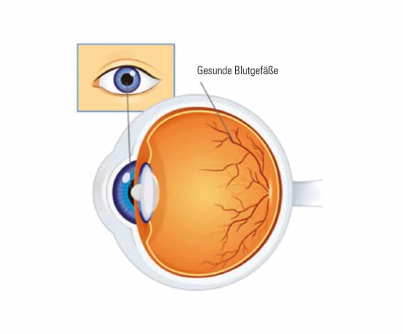 uecker-augenoptik-netzhautscan-diabtische-retinopathie-normal